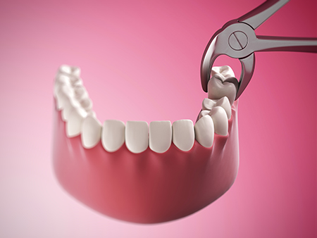 Gallavin Dentistry | Preventative Program, Dental Bridges and Emergency Treatment