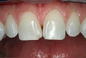 Gallavin Dentistry | Teeth Whitening, Extractions and Cosmetic Dentistry